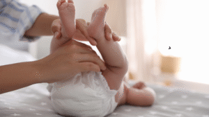 How to Treat Yeast Diaper Rash