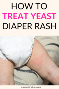 How to Treat Yeast Diaper Rash