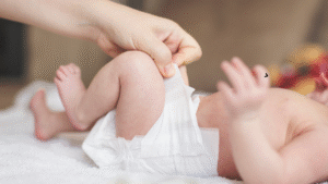 How to Treat Yeast Diaper Rash
