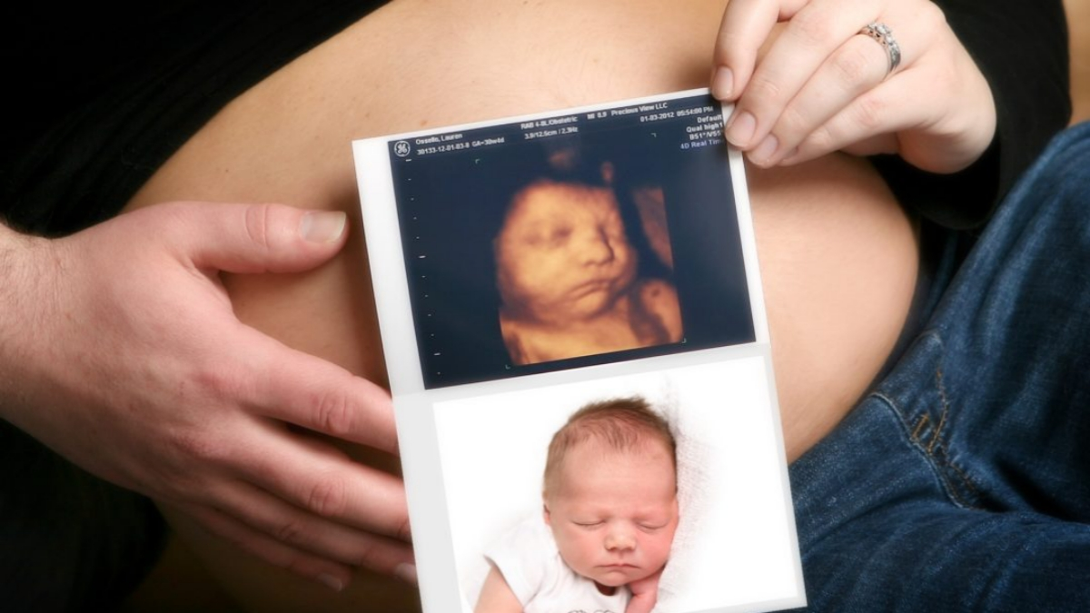 What Is a 4D Ultrasound Scan and How Does It Work?