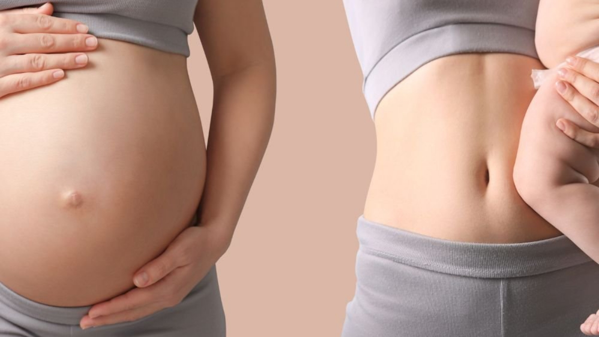 How to Tighten Loose Skin After Pregnancy: 9 Natural Ways