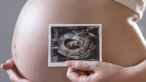 How Your First Ultrasound Can Tell The Sex Of Your Baby