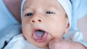 Thrush in Babies: Causes, Symptoms, and Treatment
