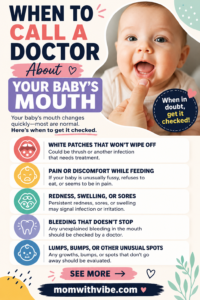 When to Call a Doctor About Your Baby’s Mouth